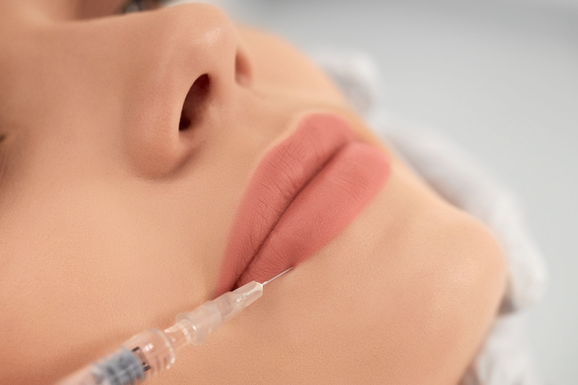 Hyaluronic Acid Filler 