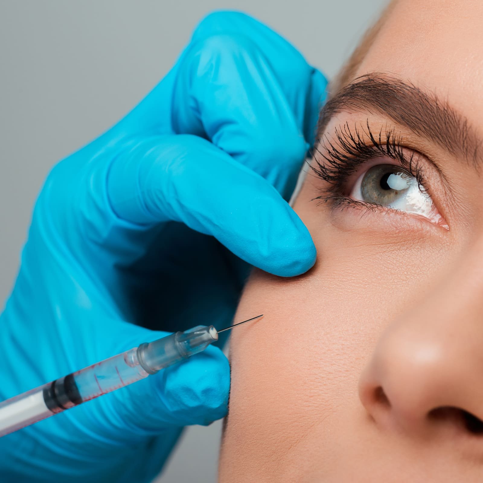 Filler e Acido Ialuronico