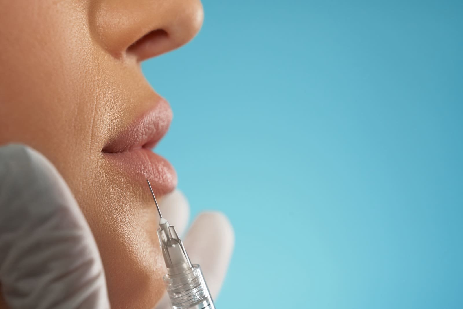 Filler Labbra