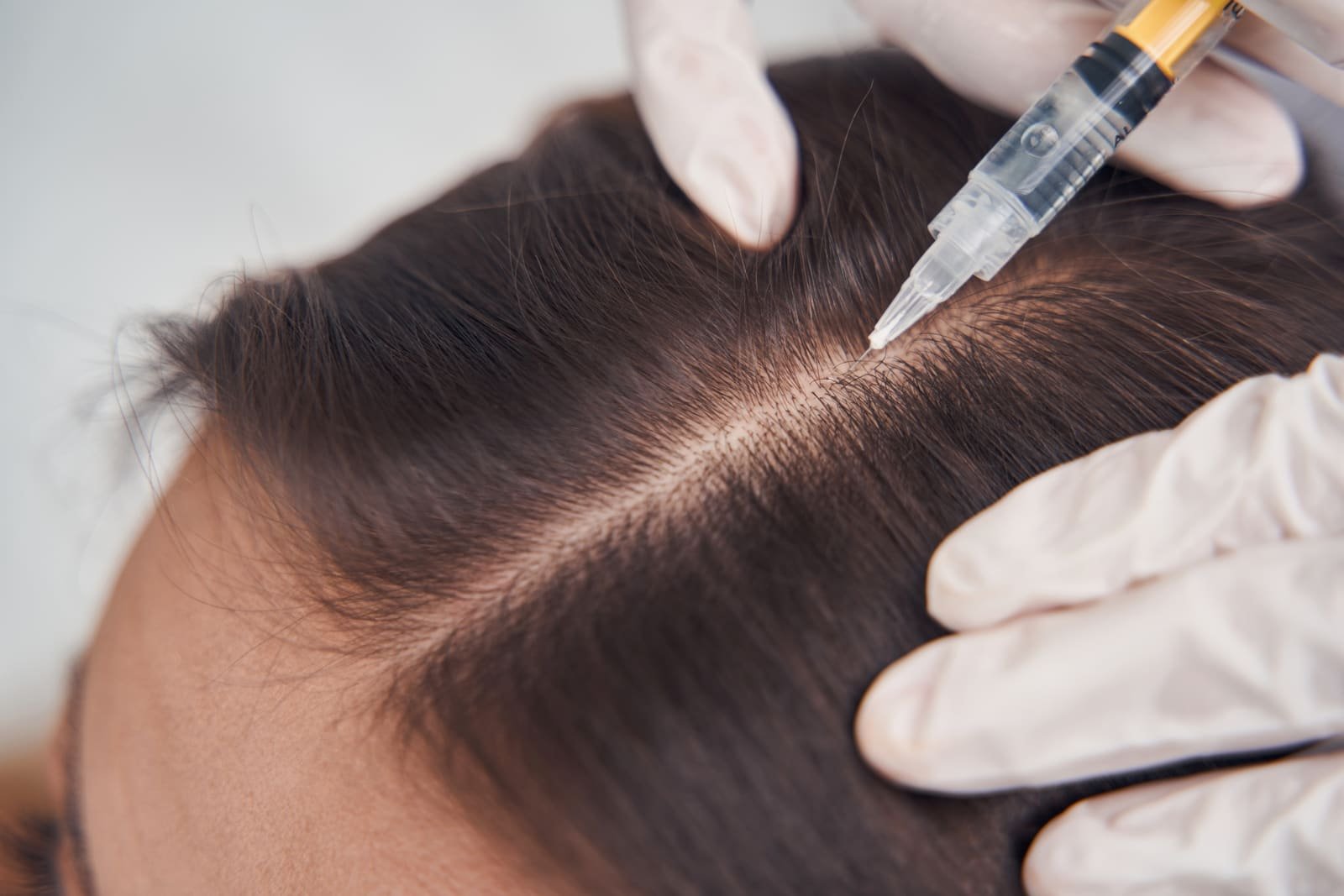 Hair filler
